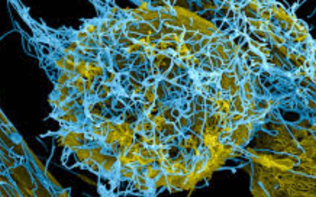 Media Messaging and American Public Perception of the Ebola Crisis of 2014 (Part Two)